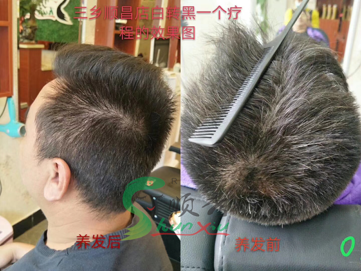 白發轉黑--2（1）