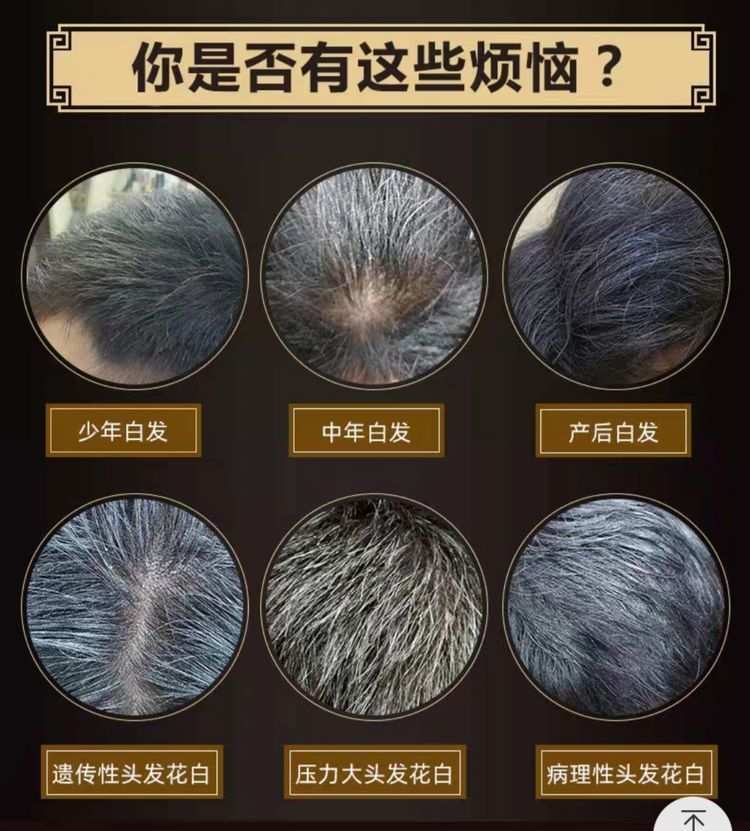 白發煩惱