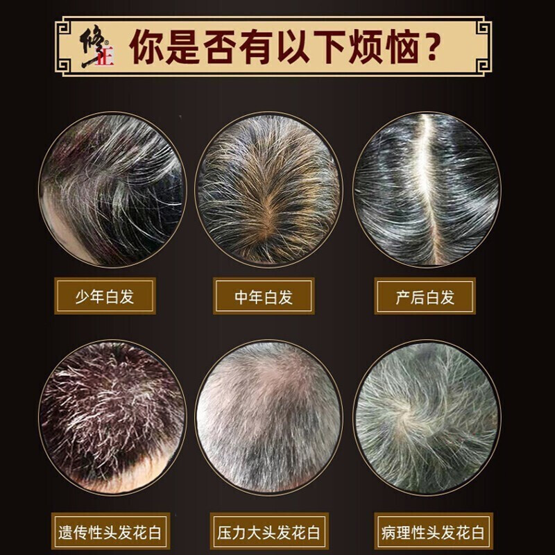 白發1